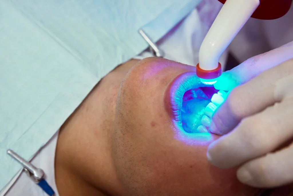 whitening