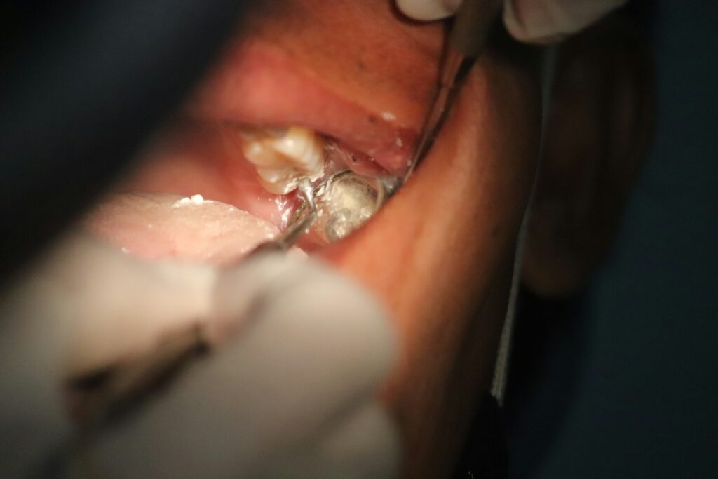 surgical periodontal therapy